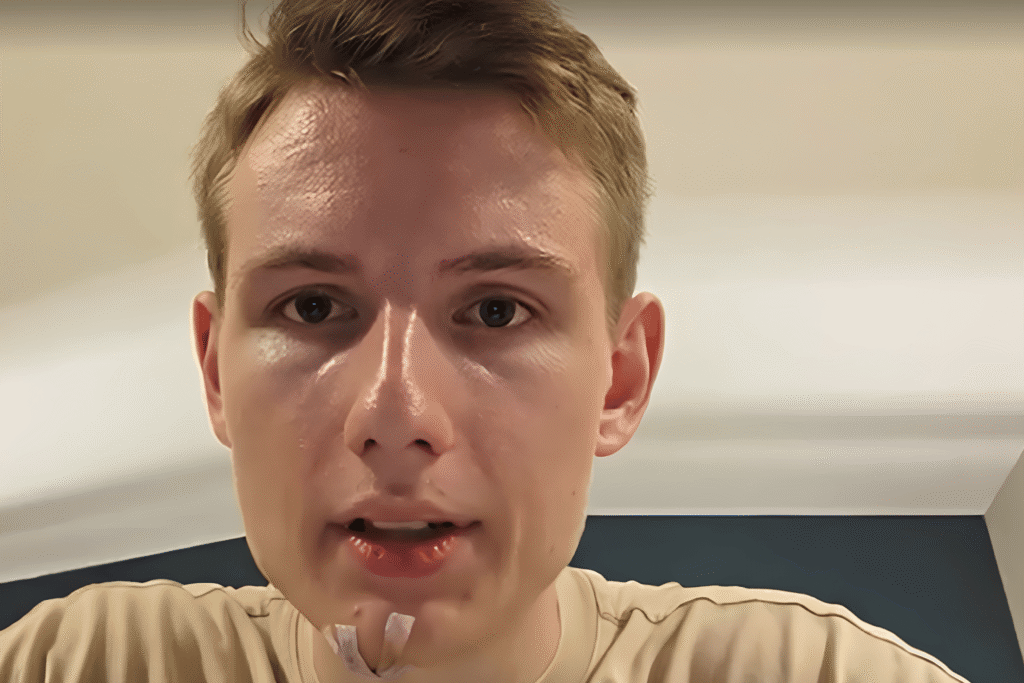 On August 18, 2026, Italian streamer itsLander was left with a bloody face after a man ran into him live on stream.